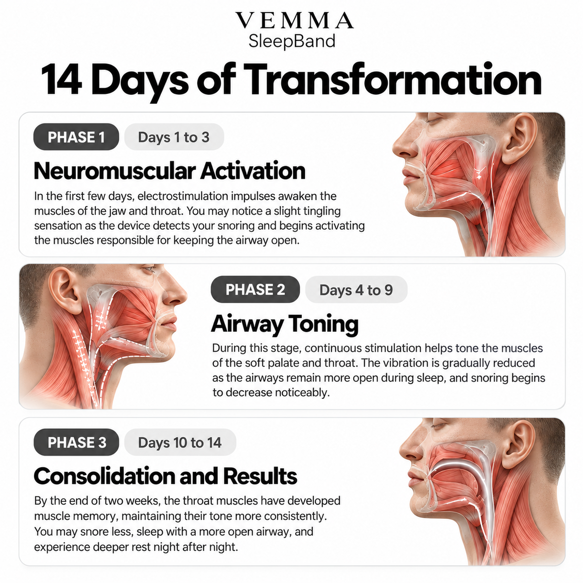 Vemma™ SleepBand